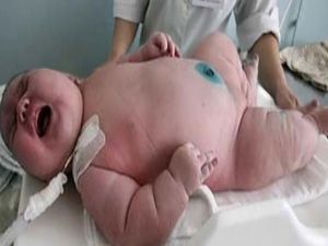 18 kilo doğan bebek doktorları şaşırttı