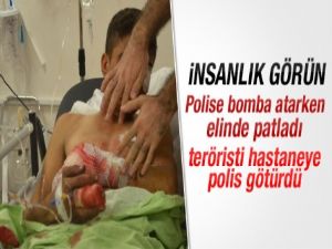 Polise atacağı bomba elinde patladı