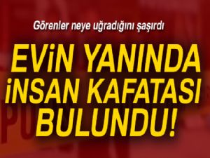 Kayseri'de insan kafatası bulundu